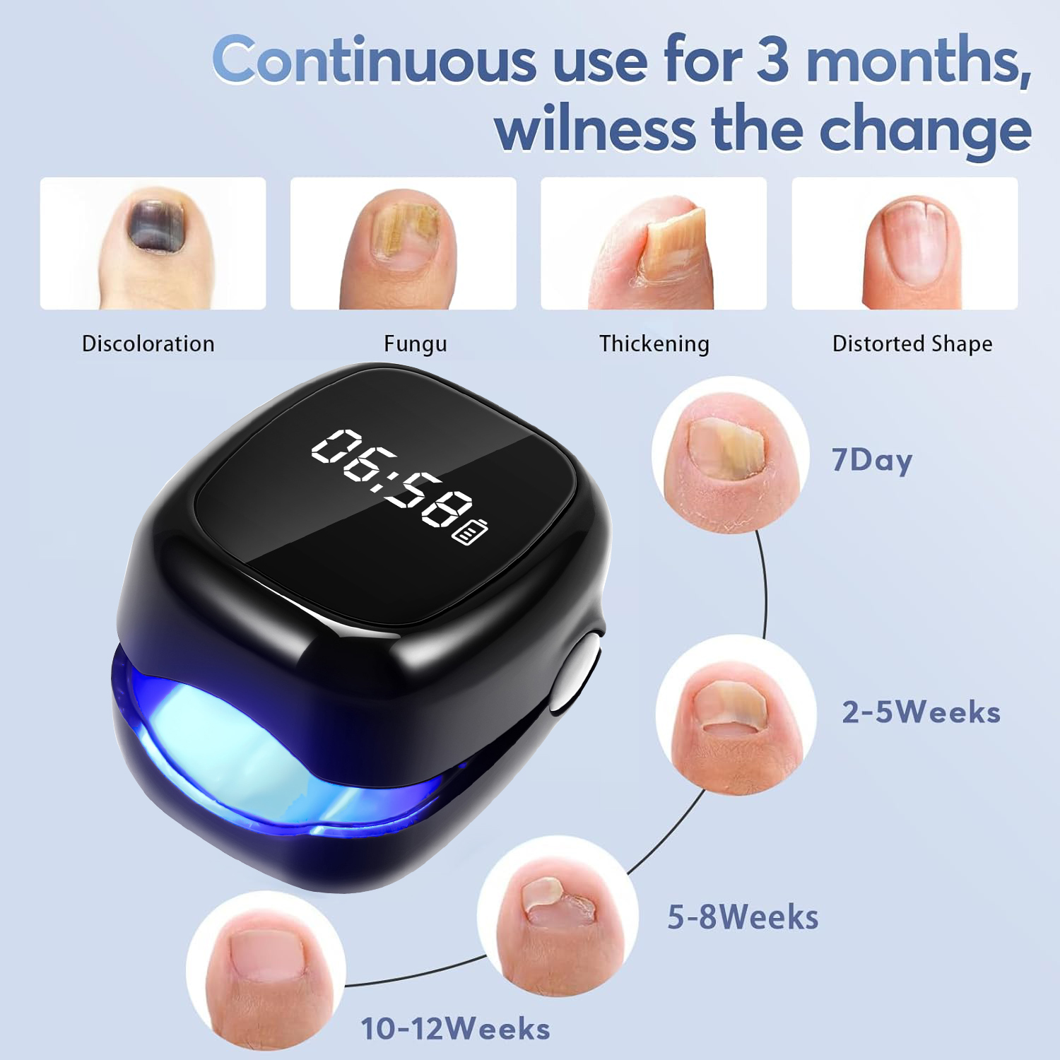UV-laserapparaat voor het verw - Uv Nail Lamp recensie en prijs