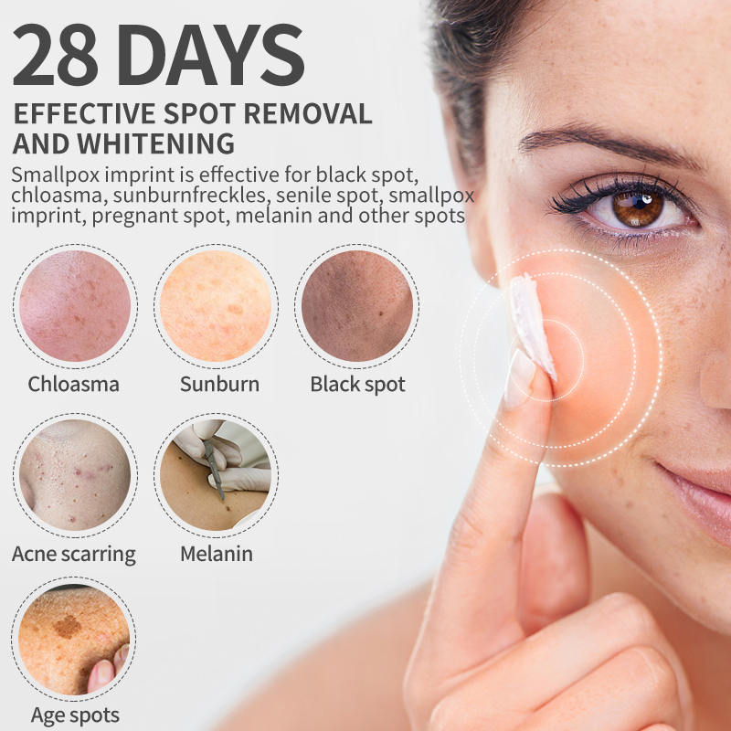 Dimollaure Whitening Sproet Cr - Beauty Glazed Makeup recensie en prijs